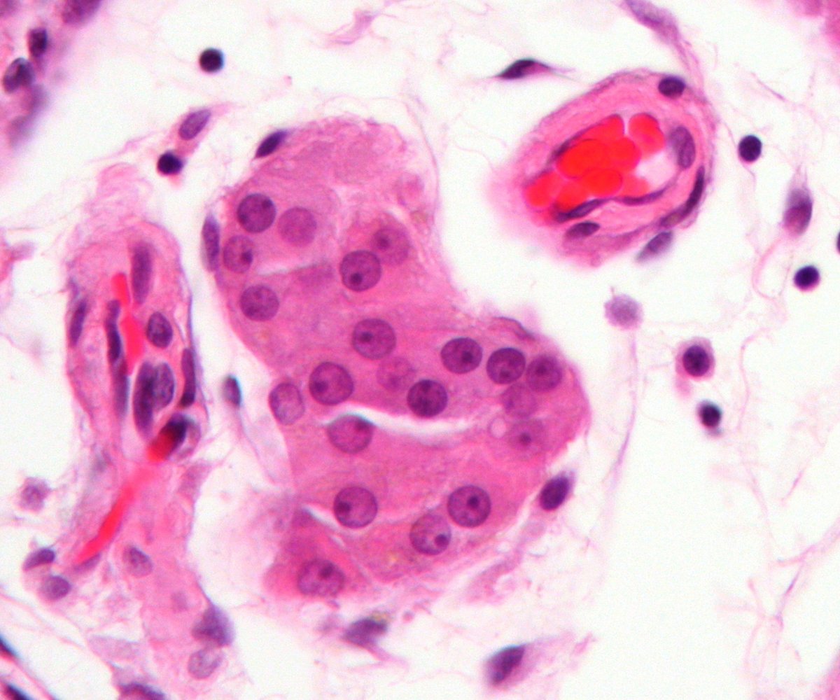 Células de Leydig al microscopio: estos grupos de células rosadas, situados entre los túbulos, son los que fabrican la testosterona.